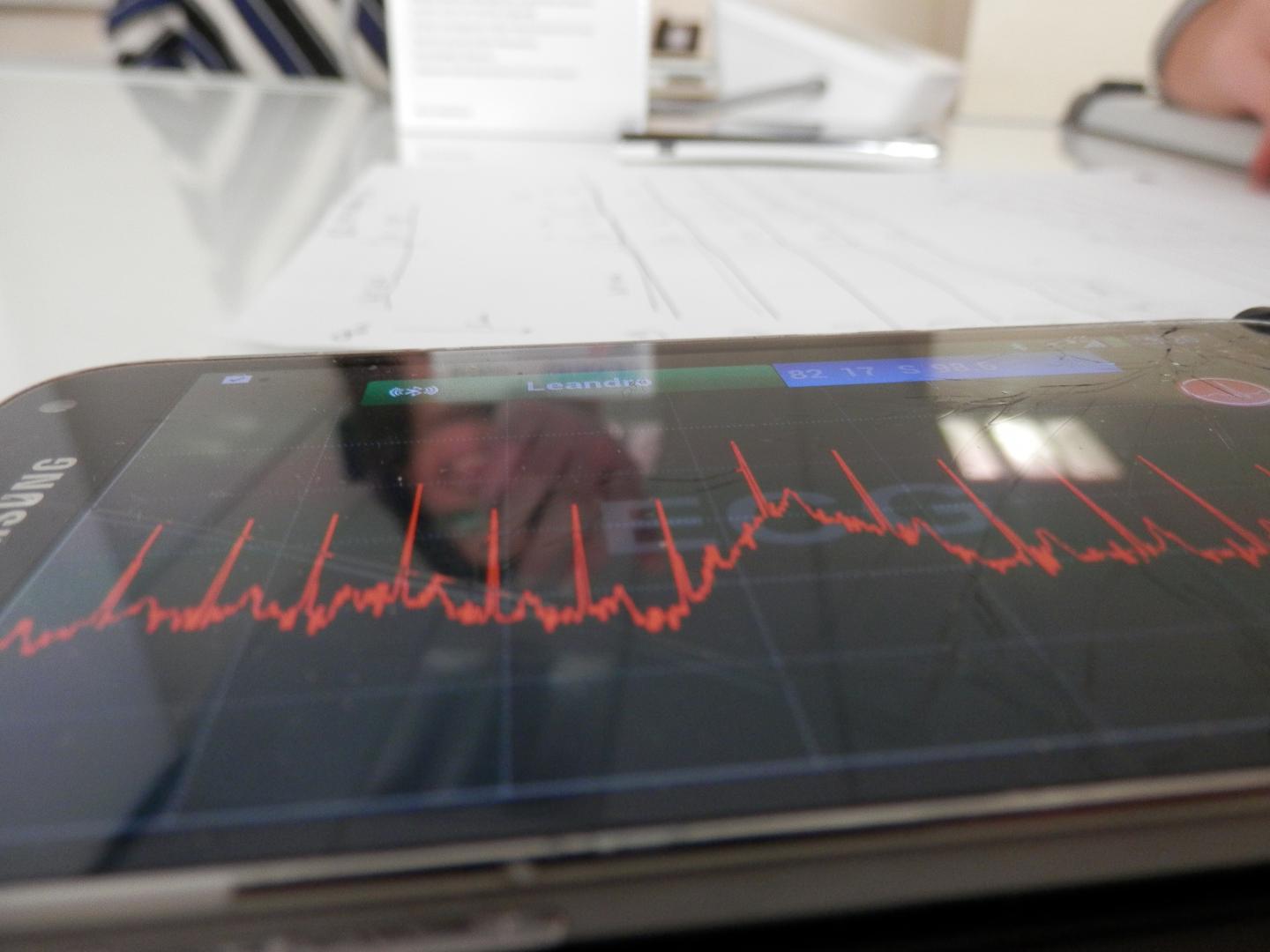 Results from State of the Art Sensor