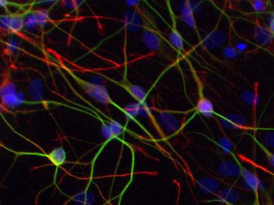 Human Neurons Differentiated from Induced Pluripotent Stem Cells