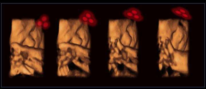 Fetus Tracking Stimulus
