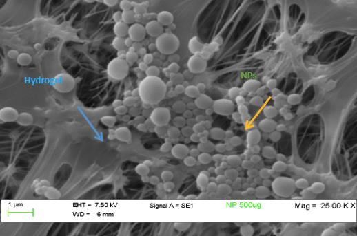 Scanning Electronic Microscopy