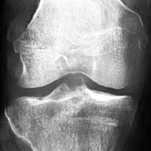 synthetic x-ray modifying animation