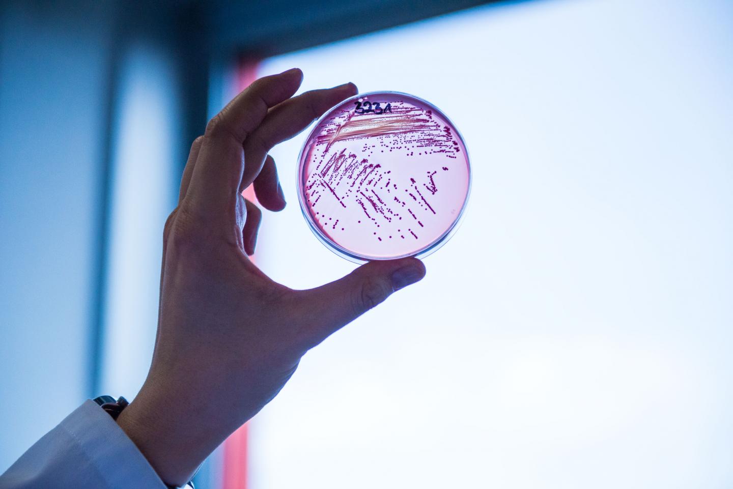 Multidrug-resistant E. coli bacteria
