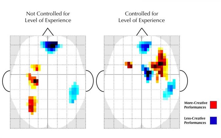 Brain Activity