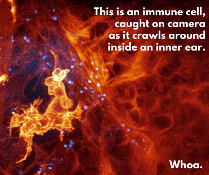 Immune Cell in Ear