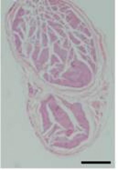 Local Application of Mitomycin C