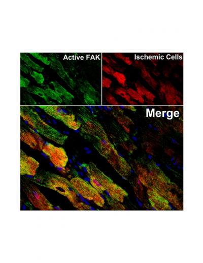 A Supercharged Protein Reduces Damage from Heart Attack