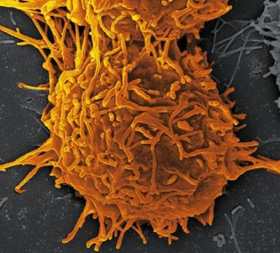 Thyroid Cancer Cell
