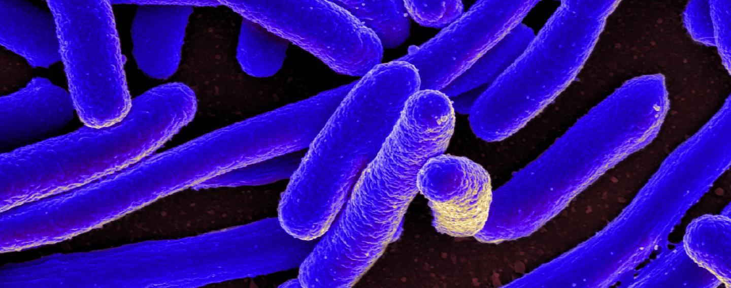 <i>Escherichia coli</i>