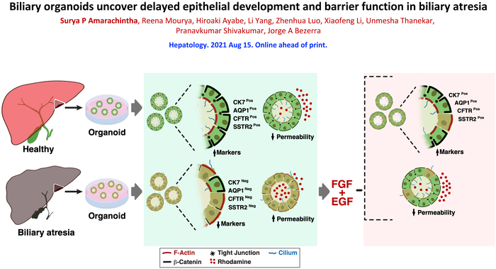 Organoids Reveal Cell Malformations in Biliary Atresia