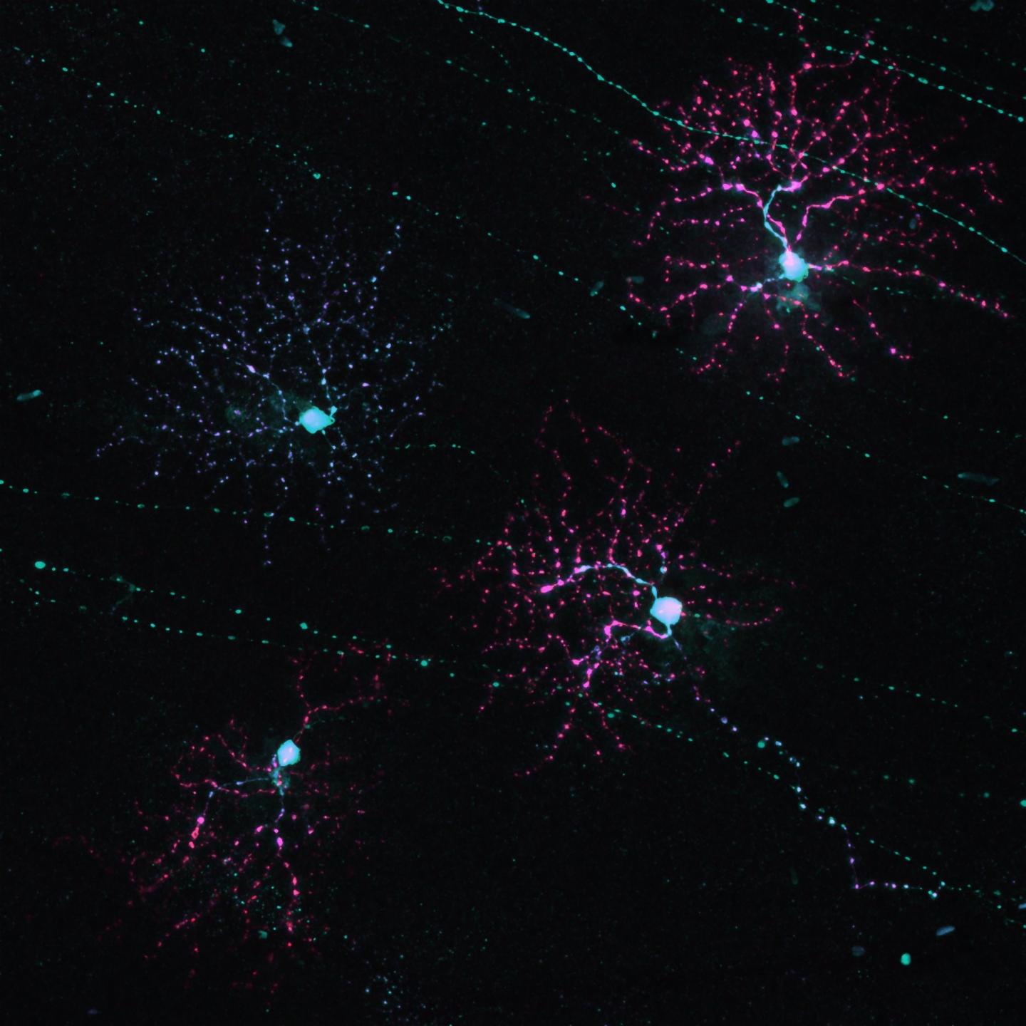 Retinal Ganglions