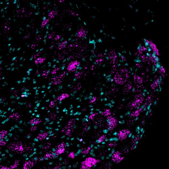 Image of Piezo2 gene expressio [IMAGE] | EurekAlert! Science News Releases