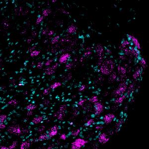 Image of Piezo2 gene expression (shown in magenta) in lumbar dorsal root ganglion sections from mice.