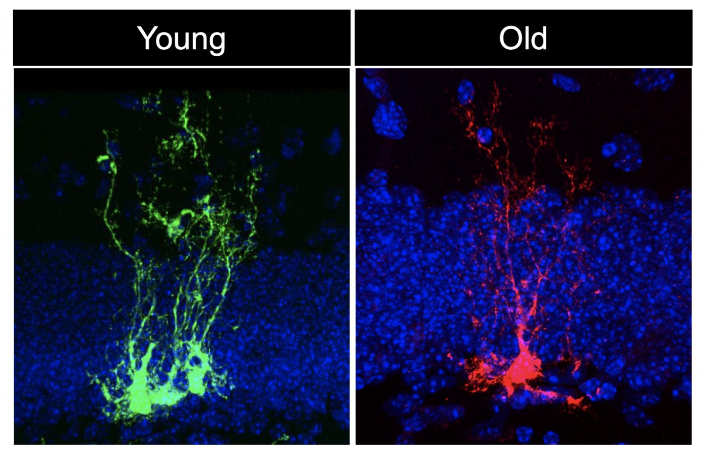 Neural Stem Cell Clones