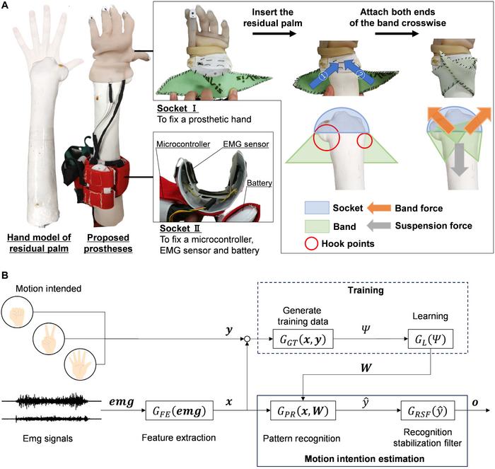 Proposed myoelectric prosthetic system.