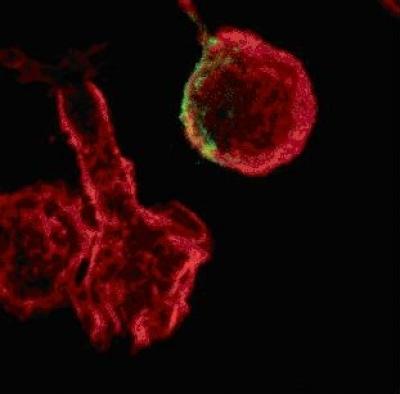 Actin Cytoskeleton of Human T-lymphocytes