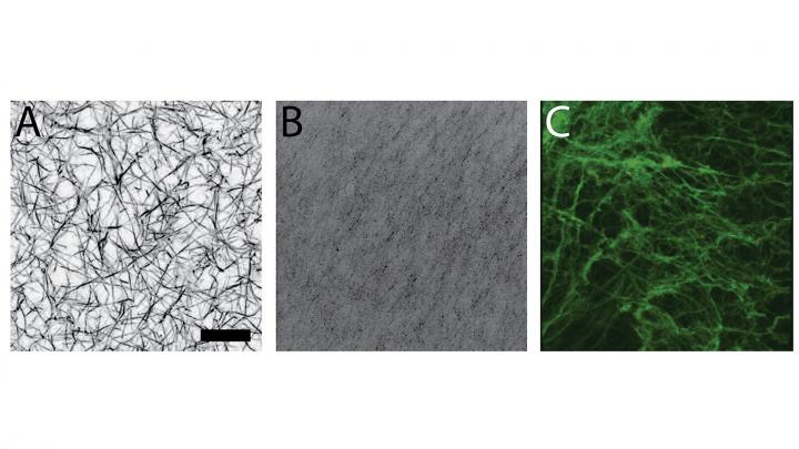 Blood Clots in Adults and Newborns