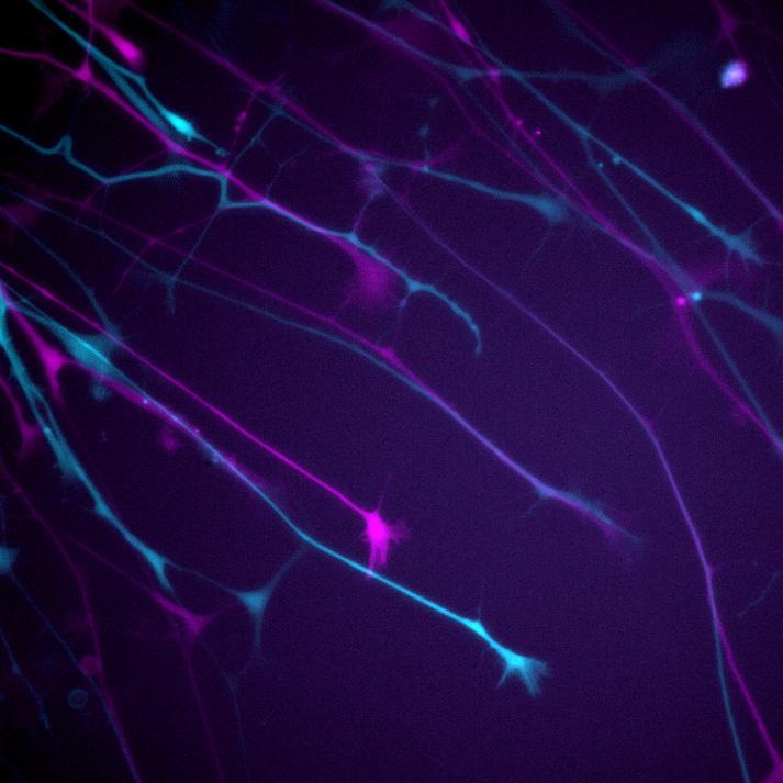 Neurons Expressing GFP