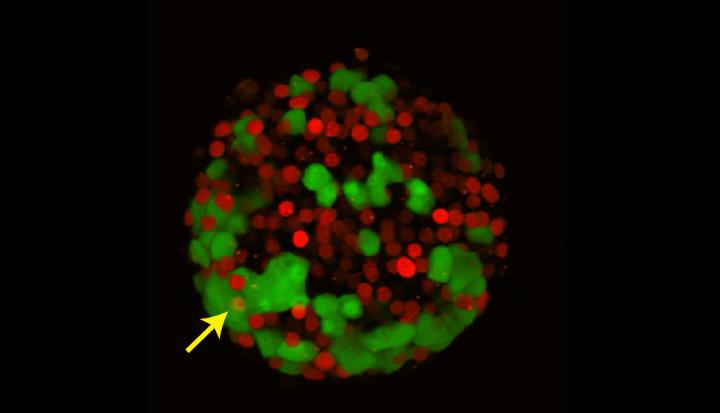 Study Refutes Using Anti-Malaria Drug to Treat Diabetes (1 of 2)