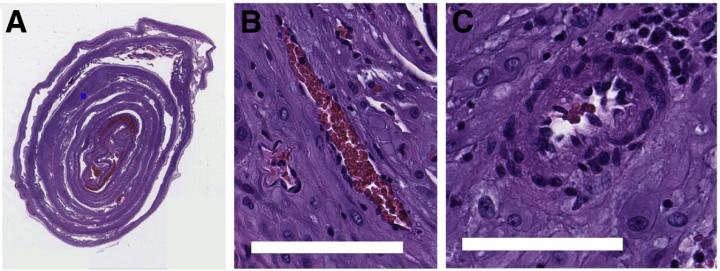 Example Image and Blood Vessel Patches from Data Set