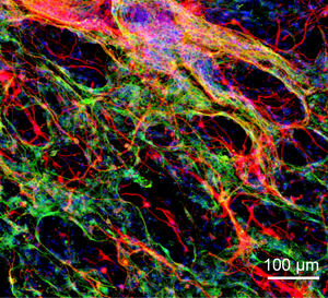 Immunofluorescence image of neurons and astrocyte cells in the engineered hydrogel