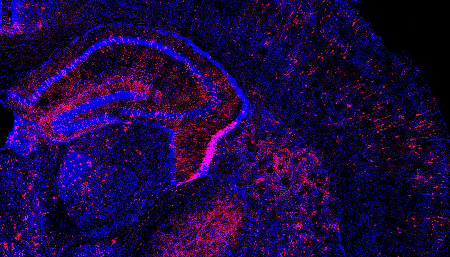 Perturb-Seq in the developing mouse brain