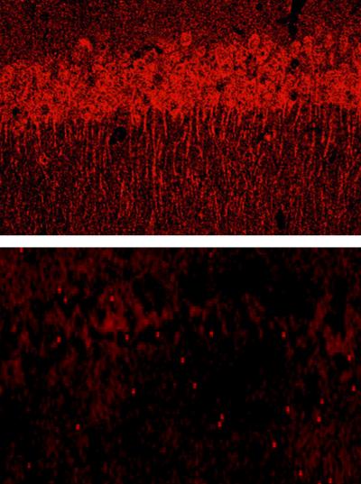 Extracellular Matrix