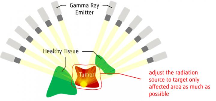 Overview of Gamma Knife Therapy