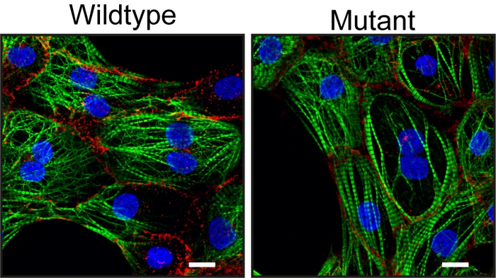 Heart muscle cells without (wildtype) or with (mutant) the newly discovered mutation.