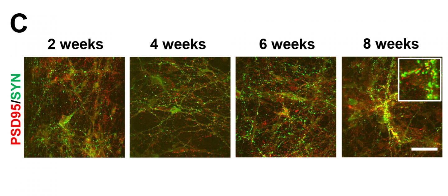 Neuronal Networks Grown in Dish Reveal Neuron Protector