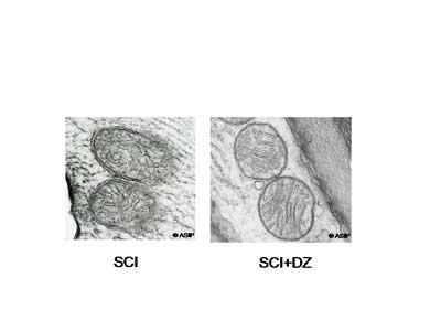 Diazoxide Prevents Mitochondrial Damage in Spinal Cord After Ischemia-Reperfusion Injury