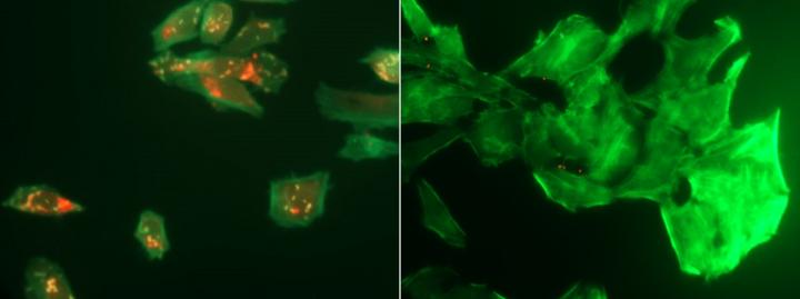 <i>L. monocytogenes</i>