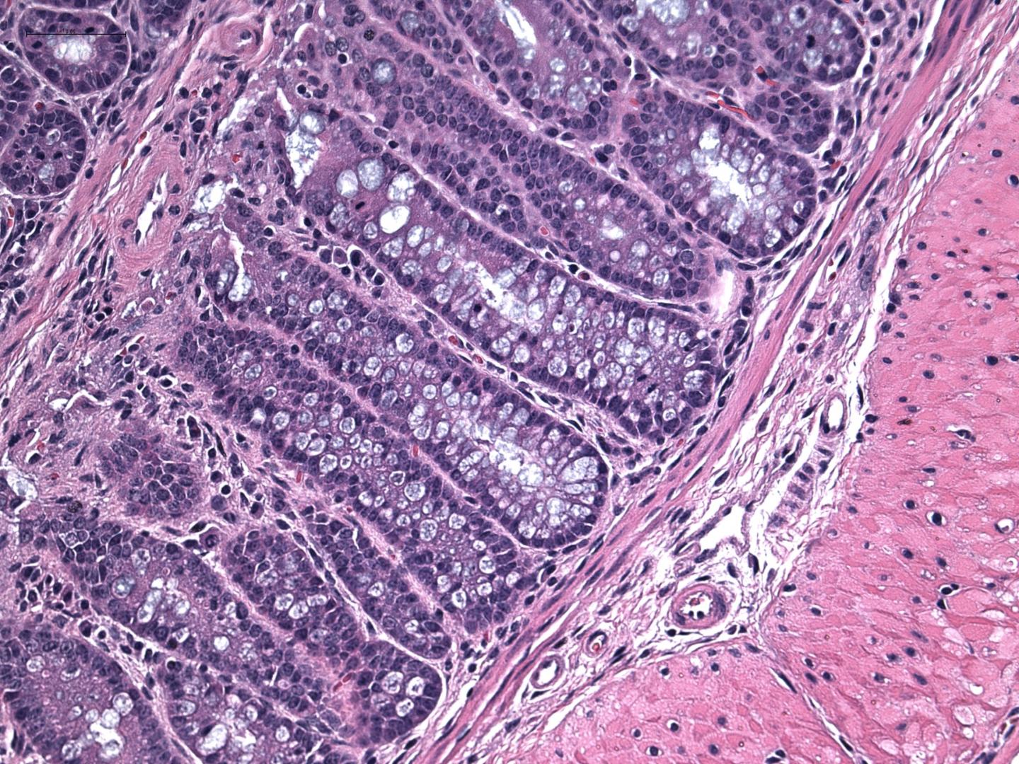 New Role for Death Molecule