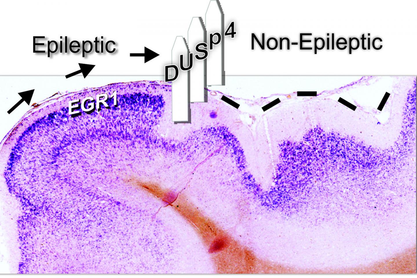 DUSP4 Illustration