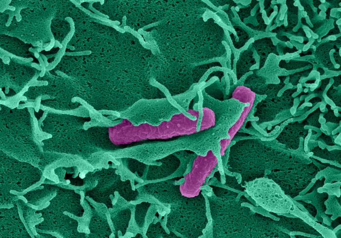 Nascent plasma membrane ruffle