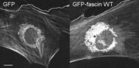 Fibroblast Cells Use Fascin to Move Their Nuclei