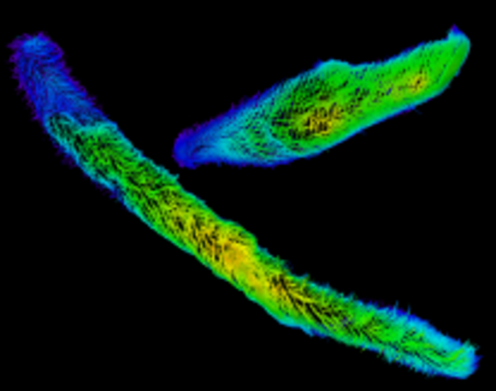 The contracted and extended states of Spirostomum cells