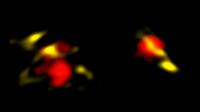 ALMA Image of Two Dusty Galaxies