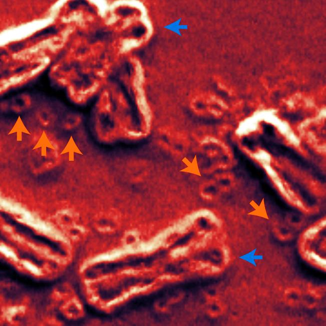 Extrachromosomal DNA