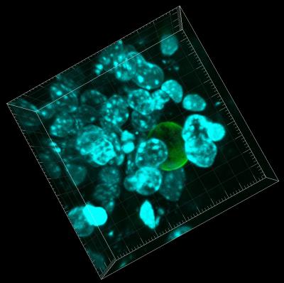 3-D Reconstruction of Cells Surrounding a Droplet in Living Tissue