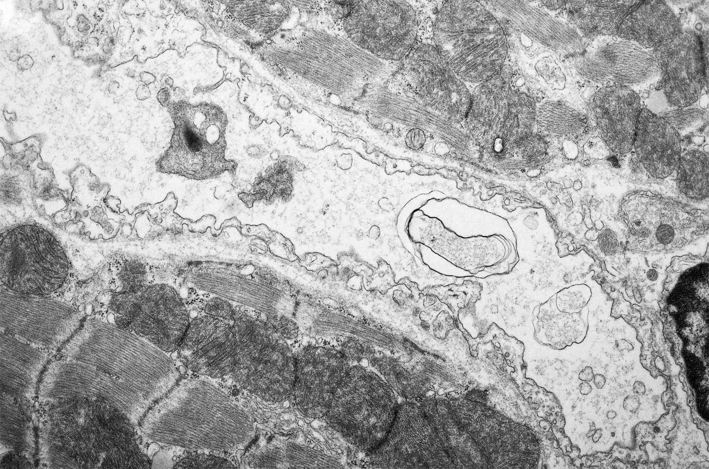 Damaged Endothelial Cells in the Heart of a Doxorubicin-Treated Mouse