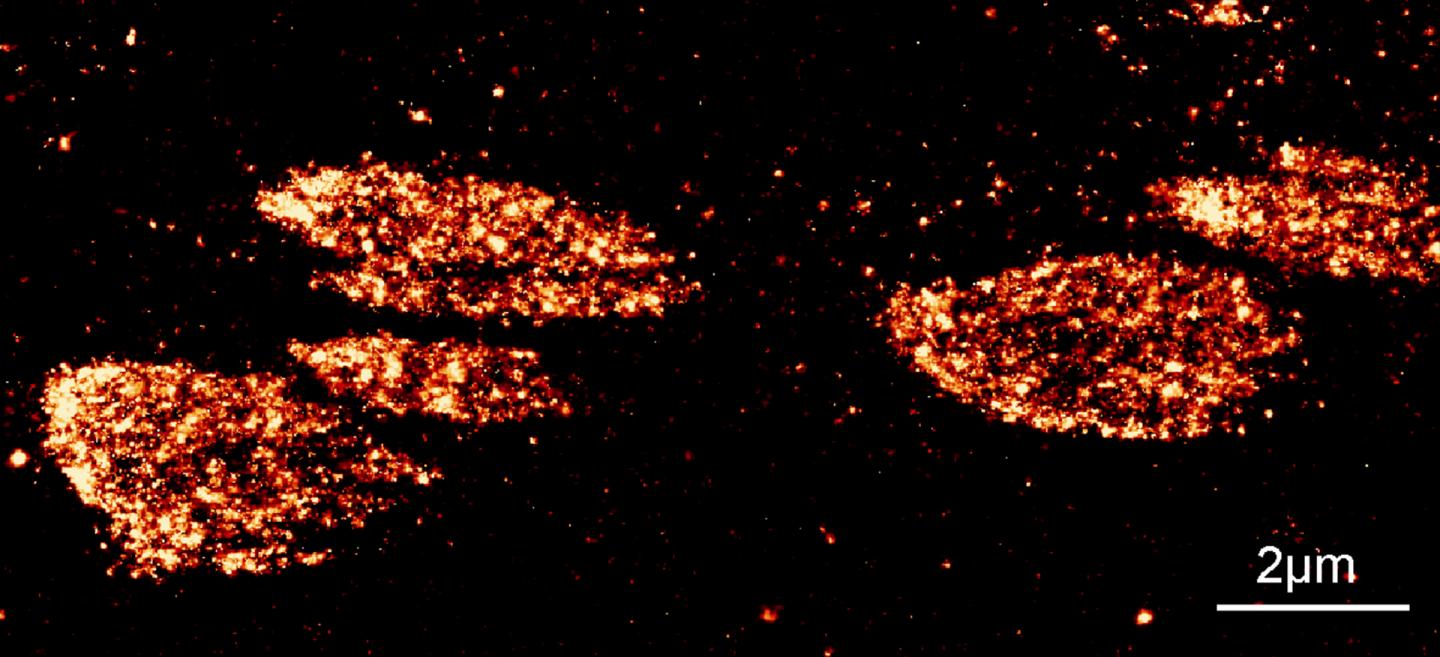 Individual Adhesion Structures with the Marked Vinculin Protein