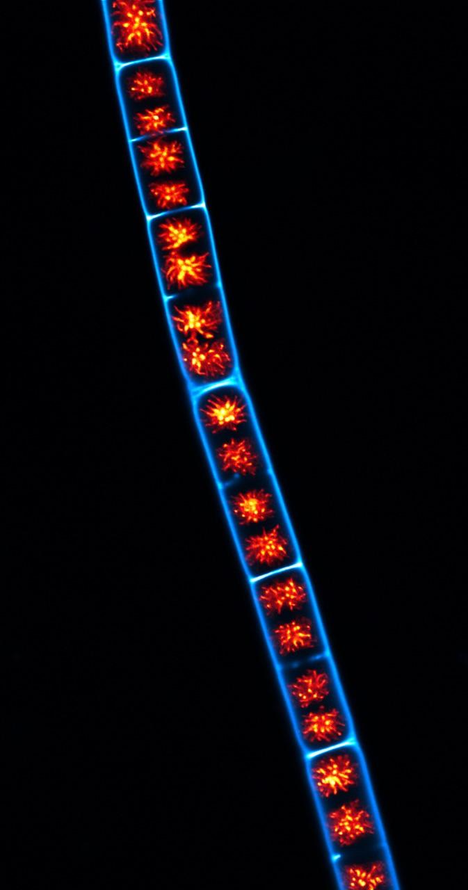 A Confocal Laser Scanning Micrograph of Zygnema Circumcarinatum