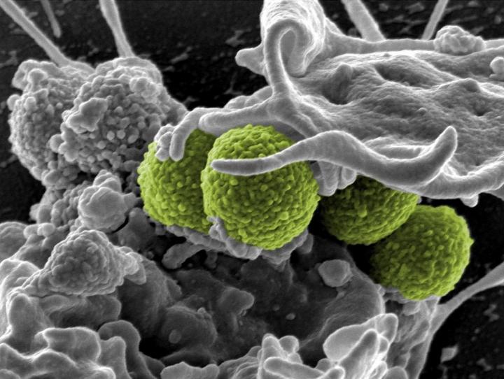 From Helpful to Harmful: Bacterial Superantigens Turn Our Immune Cells to the Dark Side