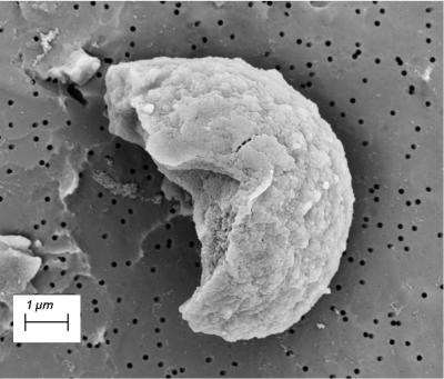 Dormant Vibrio parahaemolyticus.