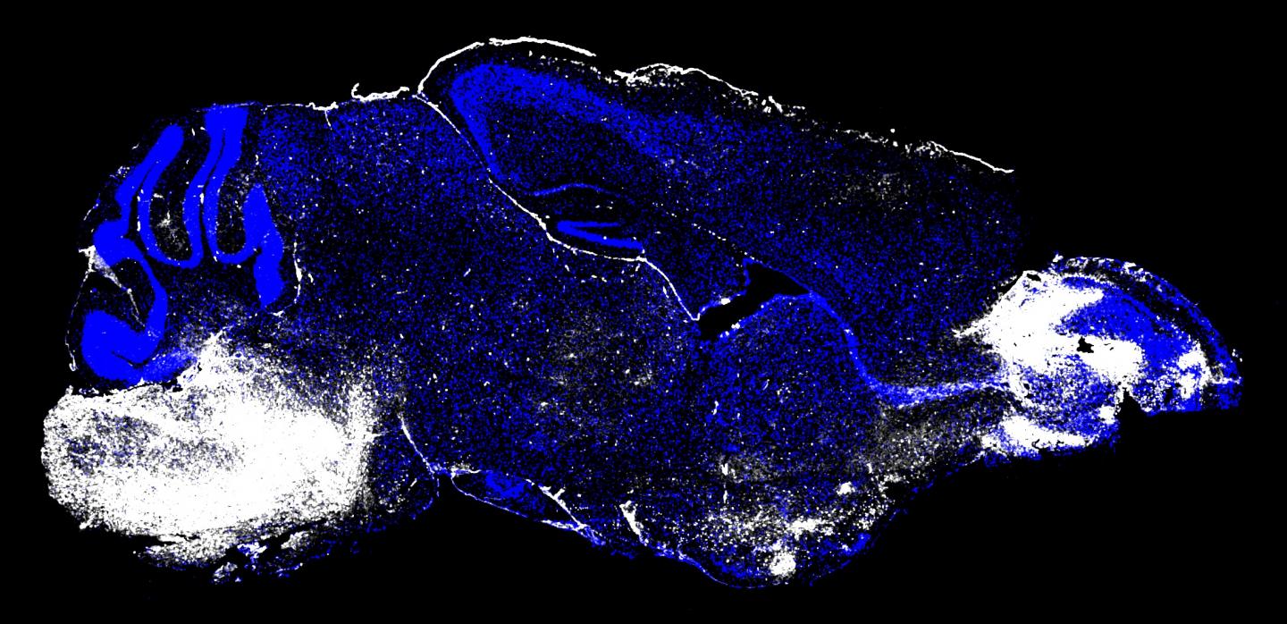 Immune System Cells Cause Severe Malaria Complication in Mouse Brain