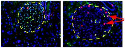 Islet Cell Proliferation in Pancreatic Islets