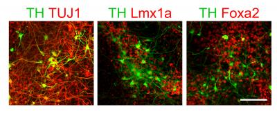 Dopaminergic Neurons