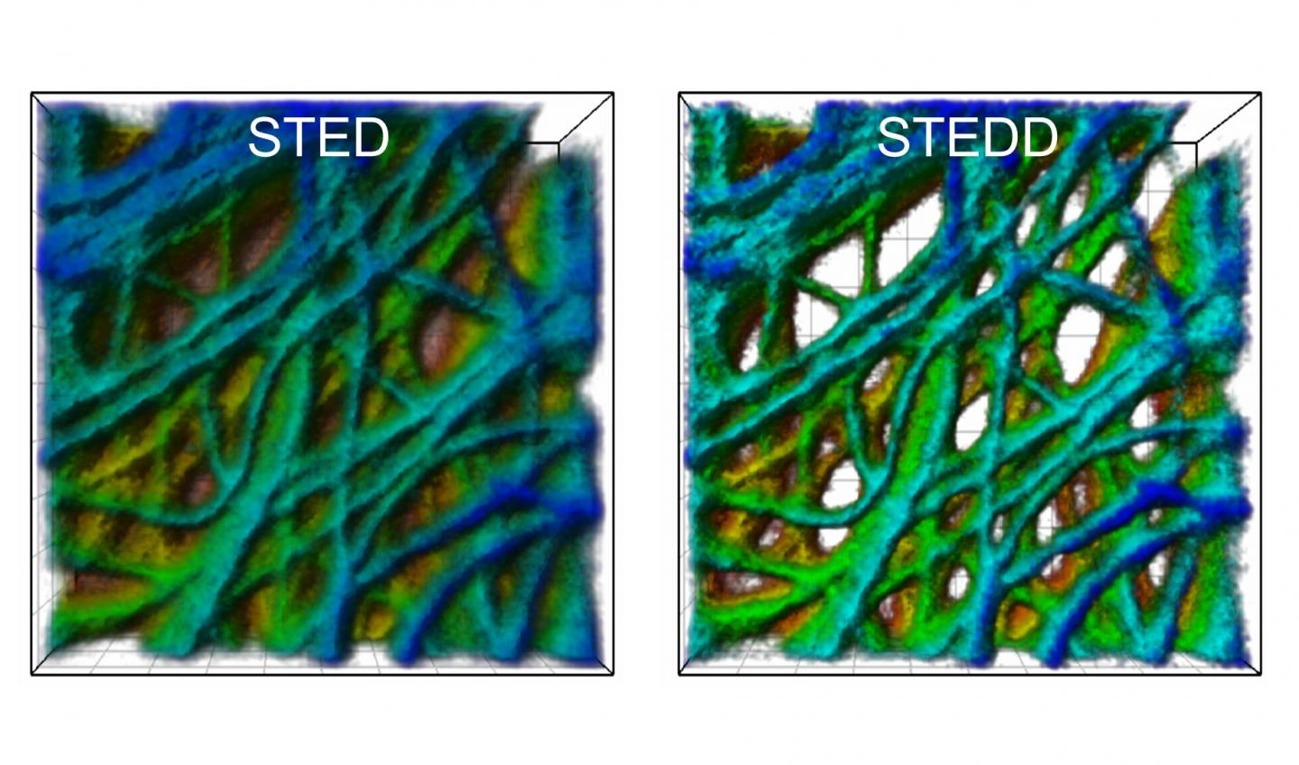 Background Suppression for Super-resolution Light Microscopy