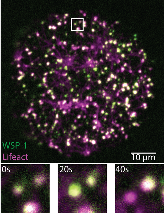 C. elegans oocyte just beginning to form its cortex