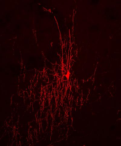 Chandelier Cells Linked to Cortical Circuits (3 of 3)